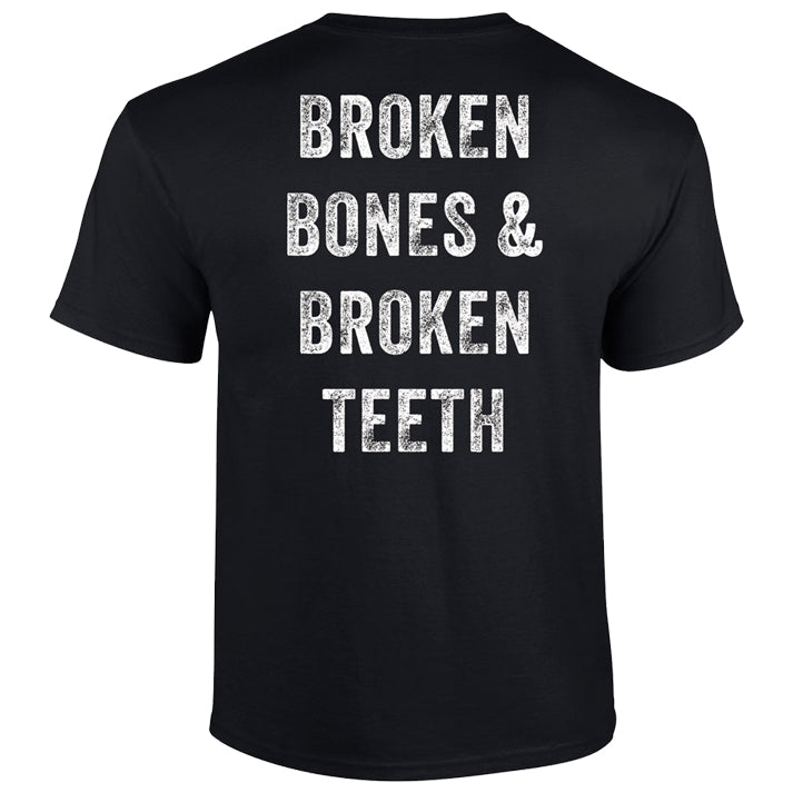 Broken Bones T-Shirt